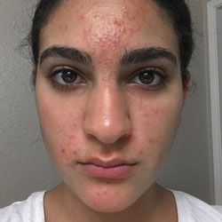 proactiv daily oil control spf 30