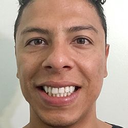 ProactivMD Results: Martin After