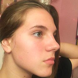 ProactivMD Results: Sabrina After